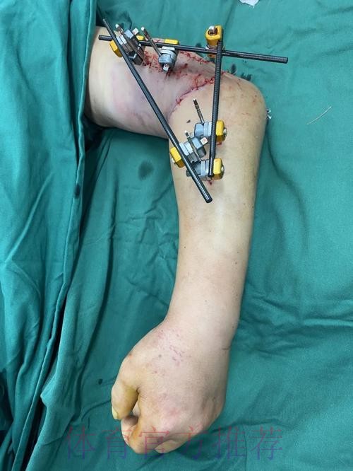 克林根击地助攻 西索科切入双手挂扣